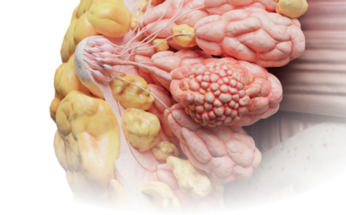 Download VOKA 3D Anatomy & Pathology