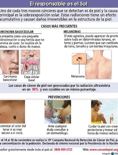 Crece el peligro del cáncer de piel: alerta por el verano