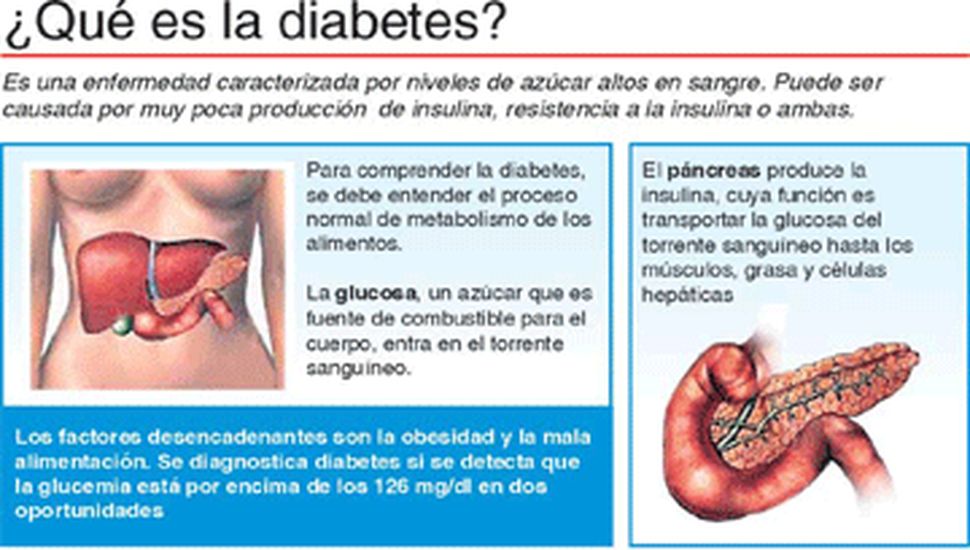 Dog Days Are Over. Amputación por diabetes: una nueva técnica podría evitar  el 76% de los casos. Фокус бг. . Inhalte im Hintergrund erstellen und  bearbeiten.