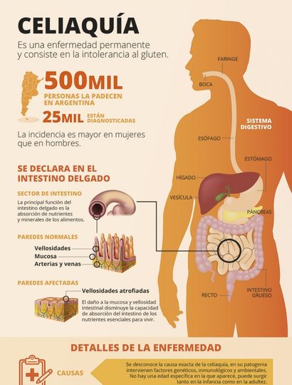 Celiaquía: las causas, los síntomas y las claves del tratamiento