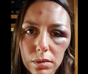Atacaron a una joven argentina