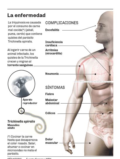 Casos sospechosos de triquinosis por consumo de carne de puma en Porvenir