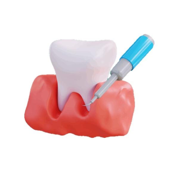 Pembersihan Karang Gigi