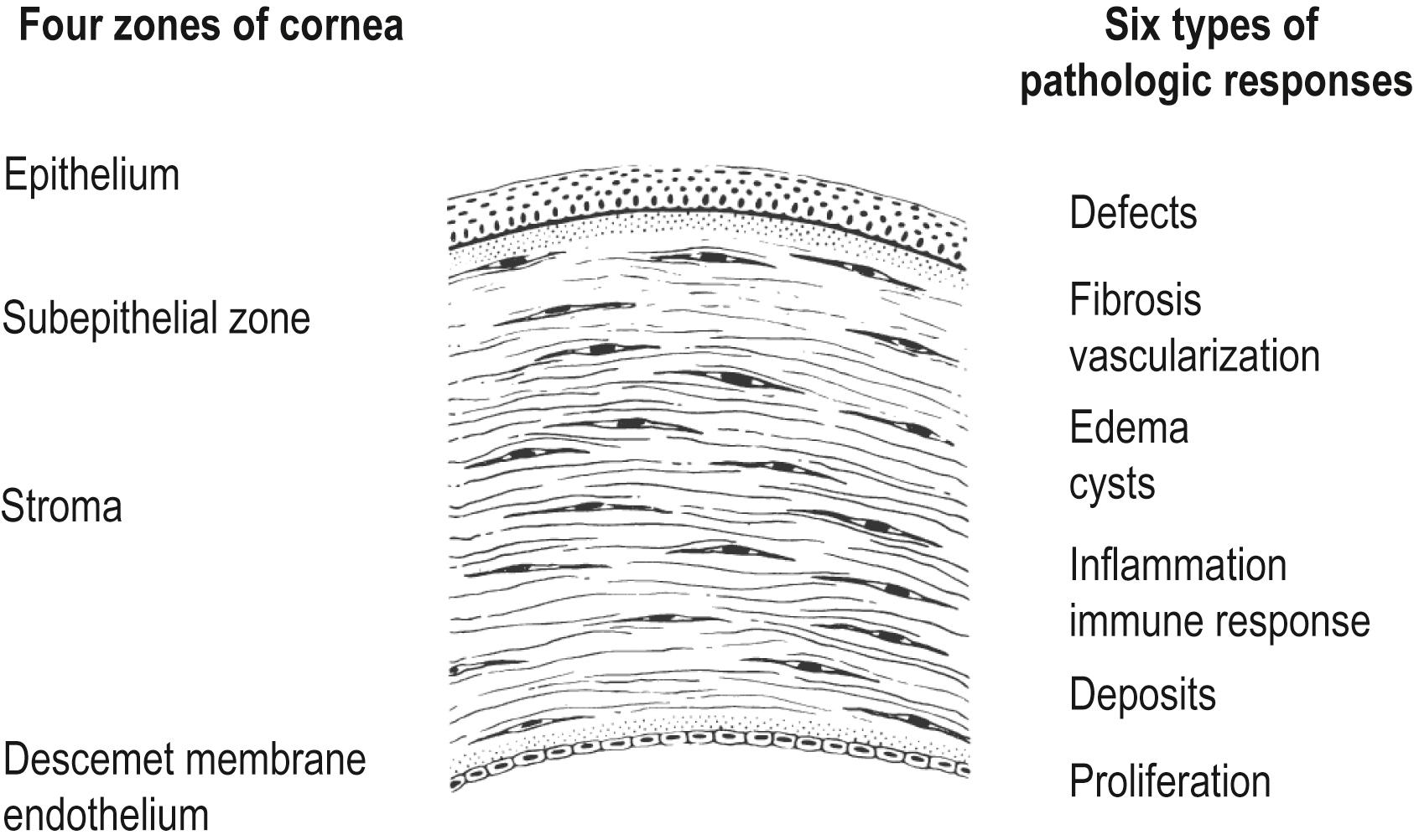 Fig. 5.1, For the purpose of discussing pathologic responses in the cornea, we can divide the cornea into four regions. Each zone can manifest six types of responses.