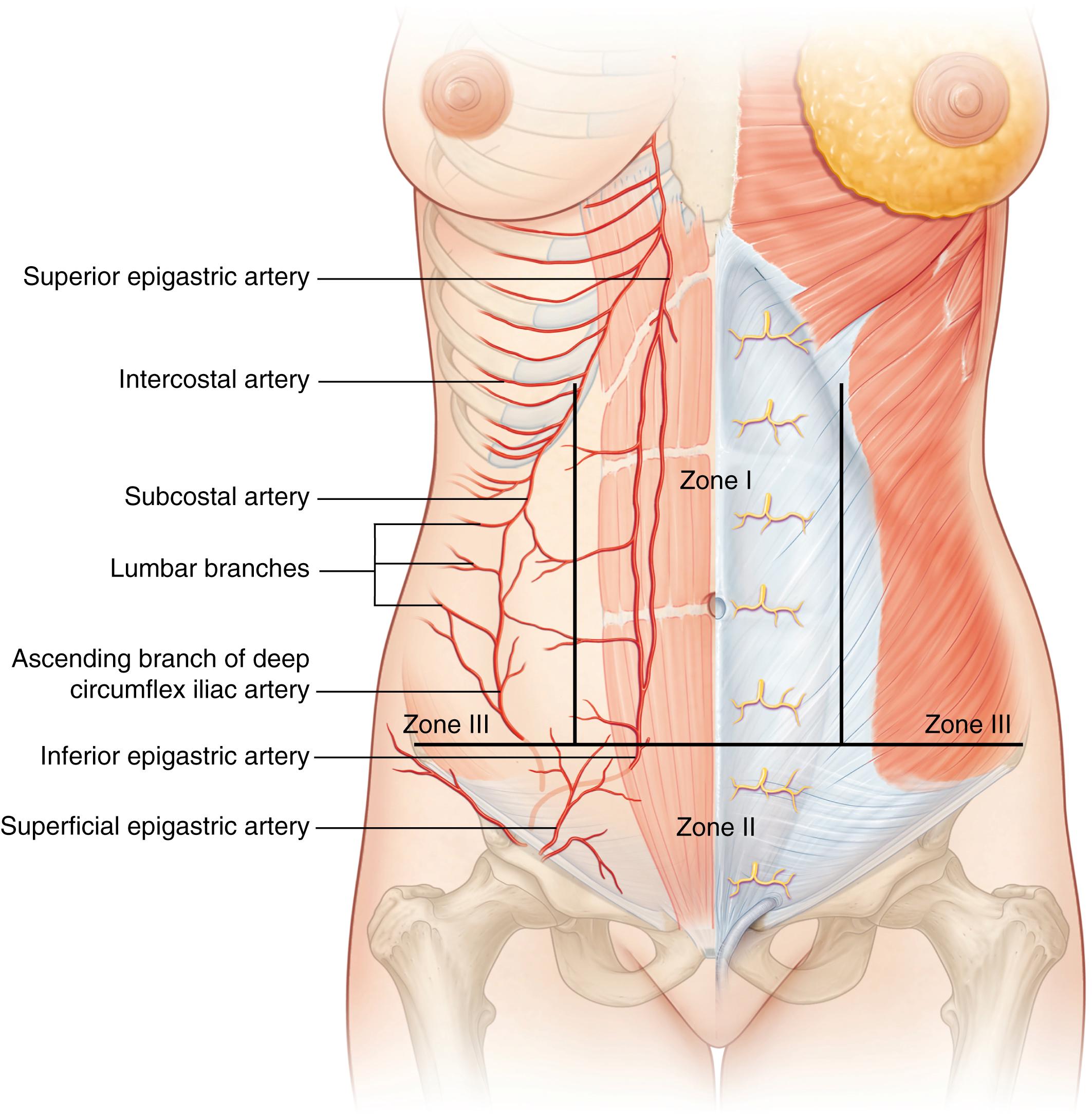 Fig. 71.2, Huge’s zones of superficial abdominal blood supply.