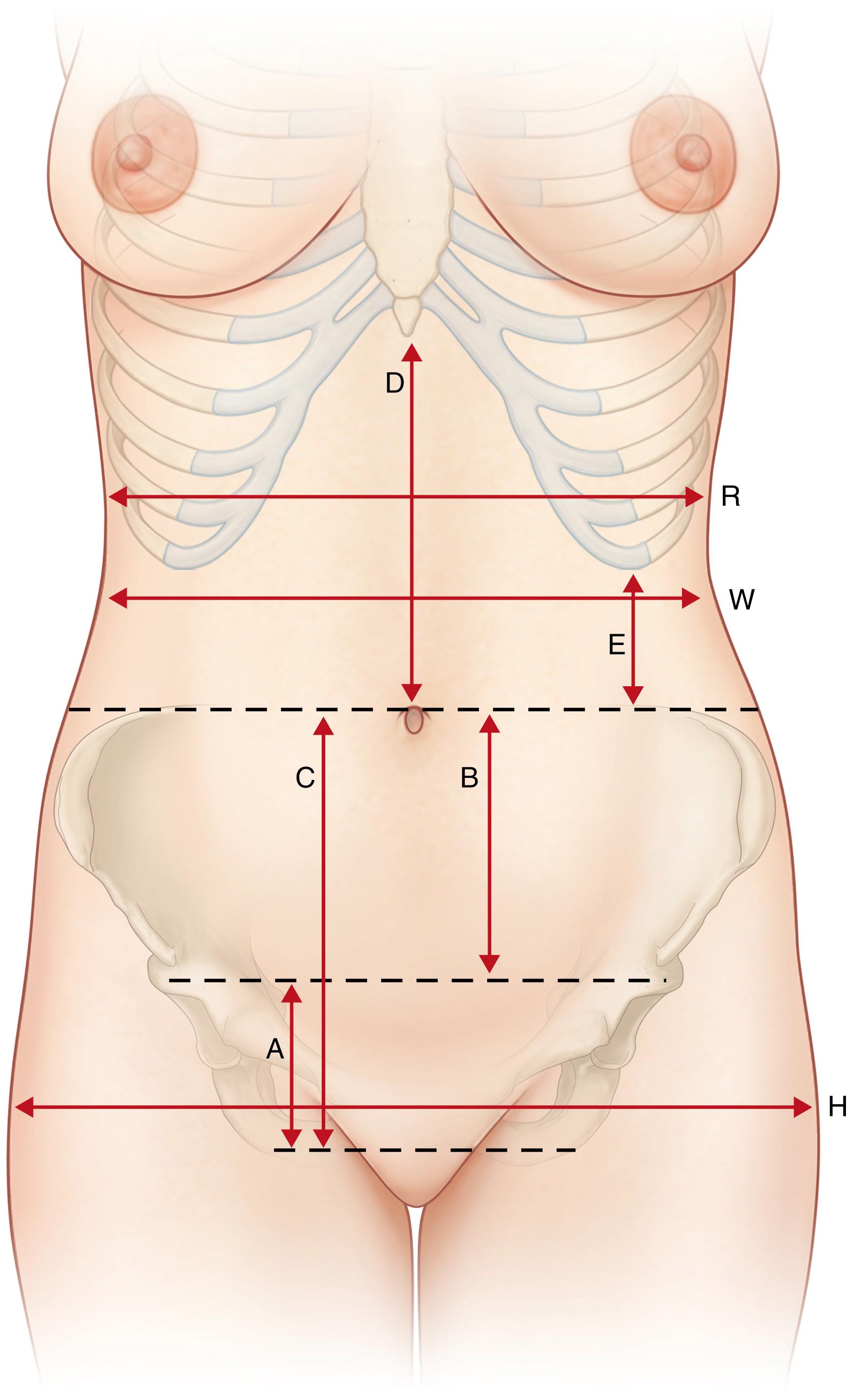 Fig. 71.4, Anatomical landmarks (see text) with normal anatomical proportions.