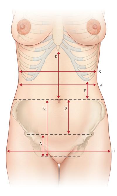 Figure 6.1, Anatomical landmarks. Normal abdominal anatomic proportions. The approximate measurements for an average female abdomen are listed. These vary according to individual height and bone structure. The umbilicus is located in line with the most superior point of the iliac crest in 99% of patients. (A) Distance between top of mons and anterior vulvar commissure. Average height is 5–7 cm. (B) Distance between umbilicus and top of mons. Average height is 11–13 cm. (C) (=A + B) Distance between umbilicus and top of anterior and vulvar commissure (C=D). (E) Distance between the costal margin and the iliac crest. The proportion of this distance to the width of the base of the rib cage (R) determines whether the patient is long waisted or short waisted. The normal proportion (E:R) is roughly 1:3 (long waisted approaches 1:2, short waisted approaches 1:3).The rib cage tapers inferiorly. A more narrow lower rib cage relative to the width under the armpits helps to emphasize the waist by creating a subtle V. (H) Hip width. A wider pelvis than rib cage emphasizes the waist; the waist is more defined when R<H. W, natural waist – the narrowest point of the torso. (Note that the umbilicus usually sits below the natural waist by about 1–4 cm). Relative to the hips, this waist-to-hip (W:H) ratio in healthy women is roughly 0.72:1; in healthy men, it is roughly 0.83:1. Note that the natural contour of the healthy abdomen reveals a subtle epigastric sagittal depression transitioning to a mild infraumbilical convexity. A subtle vertical sulcus at the lateral rectus border, which is more distinct in a muscular person, may also be seen.