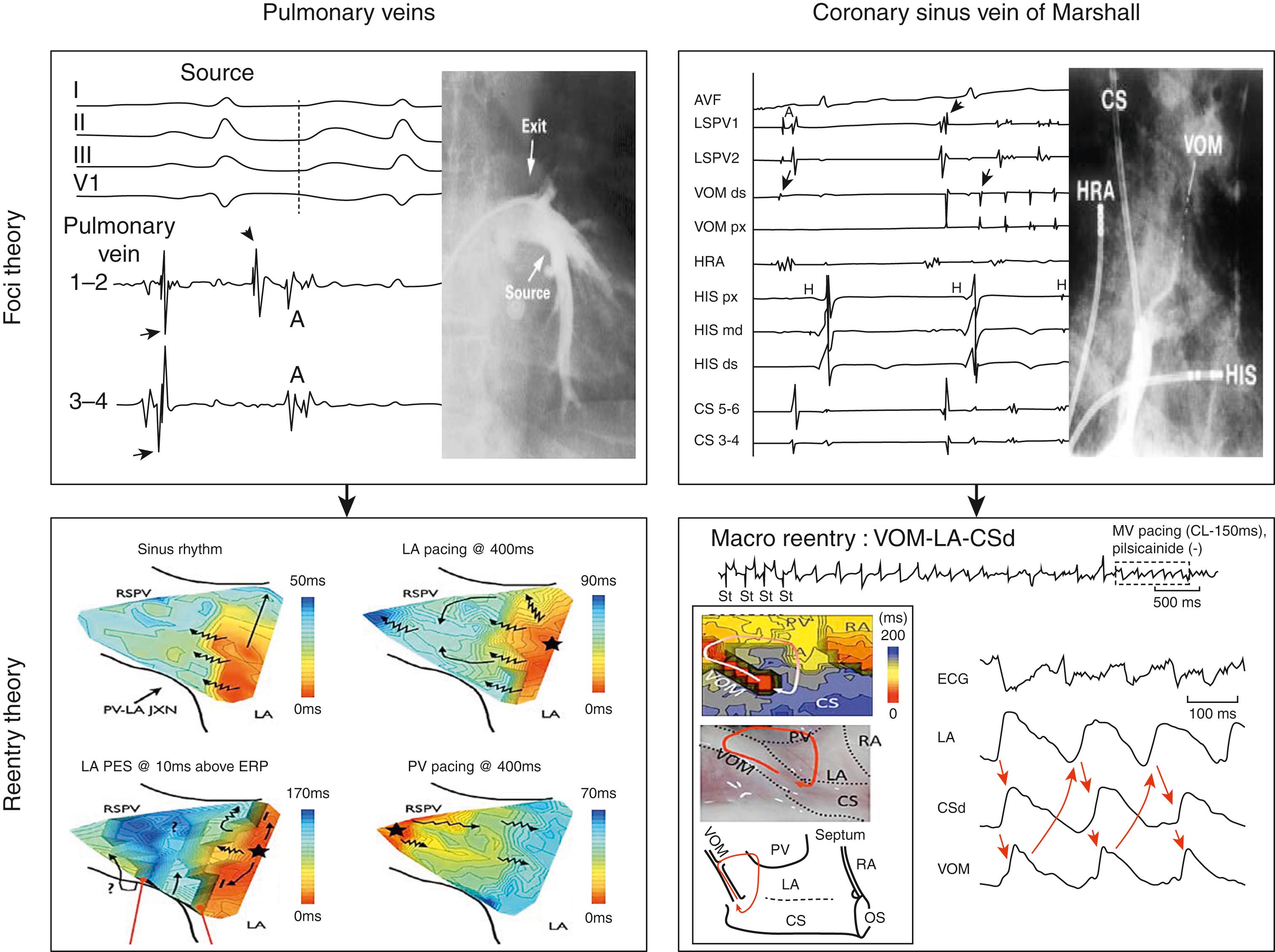 Fig. 76.1, Two mechanistic theories for a single anatomy.