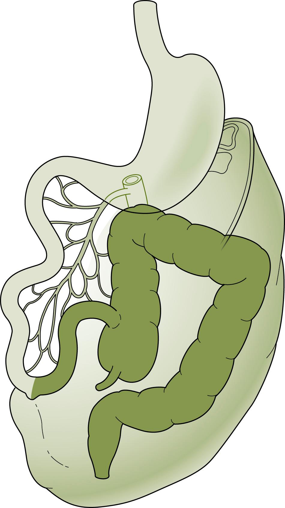 Fig. 56.3, Nonrotation.