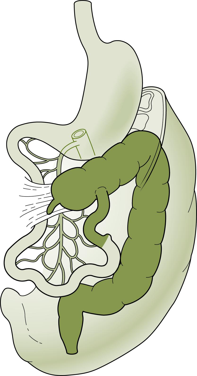 Fig. 56.4, Incomplete Rotation.