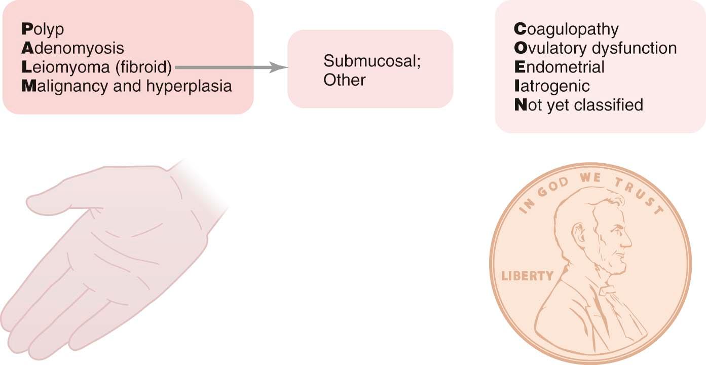 FIGURE 26-1, PALM-COEIN classification system for abnormal uterine bleeding that has been approved by the International Federation of Gynecology and Obstetrics.