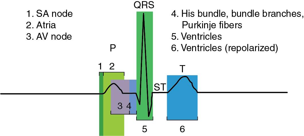 Fig. 8.3, Physiologic actions represented in the electrocardiogram (ECG). Relation between cardiac depolarization, ventricular repolarization, and appearance of the normal ECG, including P wave, QRS complex, ST segment, and T wave. The PR interval can be prolonged by disease from the atria to the Purkinje fibers (steps 2–4). The sinoatrial (SA) node is not seen on the surface ECG due to its small mass; its activity is inferred from the P wave, which reflects atrial activation. AV, Atrioventricular.