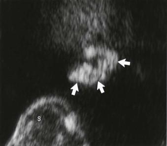 FIGURE 13-17, Malformed and rotated ear.