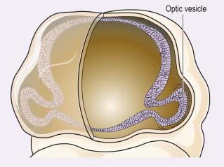 FIGURE 13-3, Embryology of the eye. Appearances at weeks.