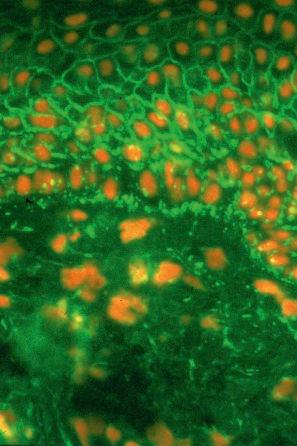 Fig. 5.32, Pemphigus erythematosus: typical intercellular immunofluorescence with granular staining (IgG) at the basement membrane region.