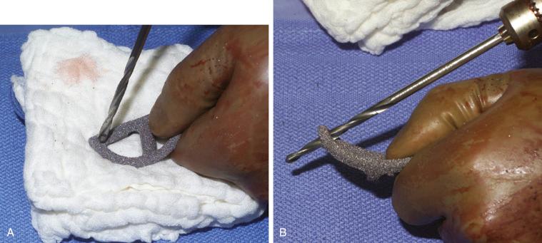 FIGURE 59A.5, A and B, Additional screw holes can be made through the augments.