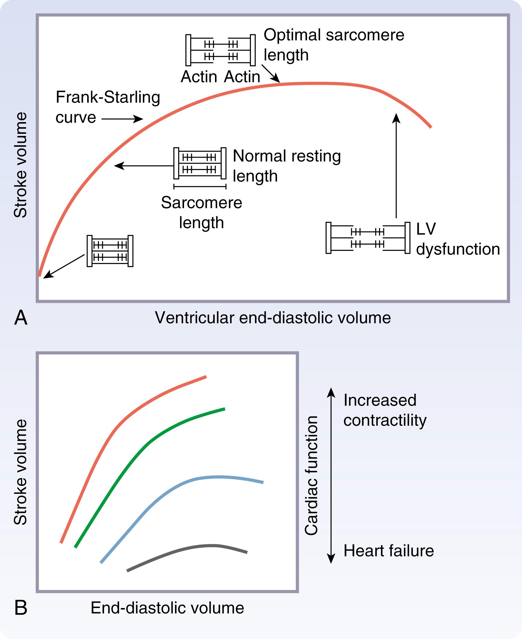 Fig. 61.12, Frank Starling curve. The Frank-Starling law describes a generally linear relationship between increasing end-diastolic volume (EDV), or preload, and generated ventricular pressure. (A) Shifts in volume change generated pressure/stroke volume along a given pressure-volume curve. (B) Cardiomyopathy shifts curve downward.