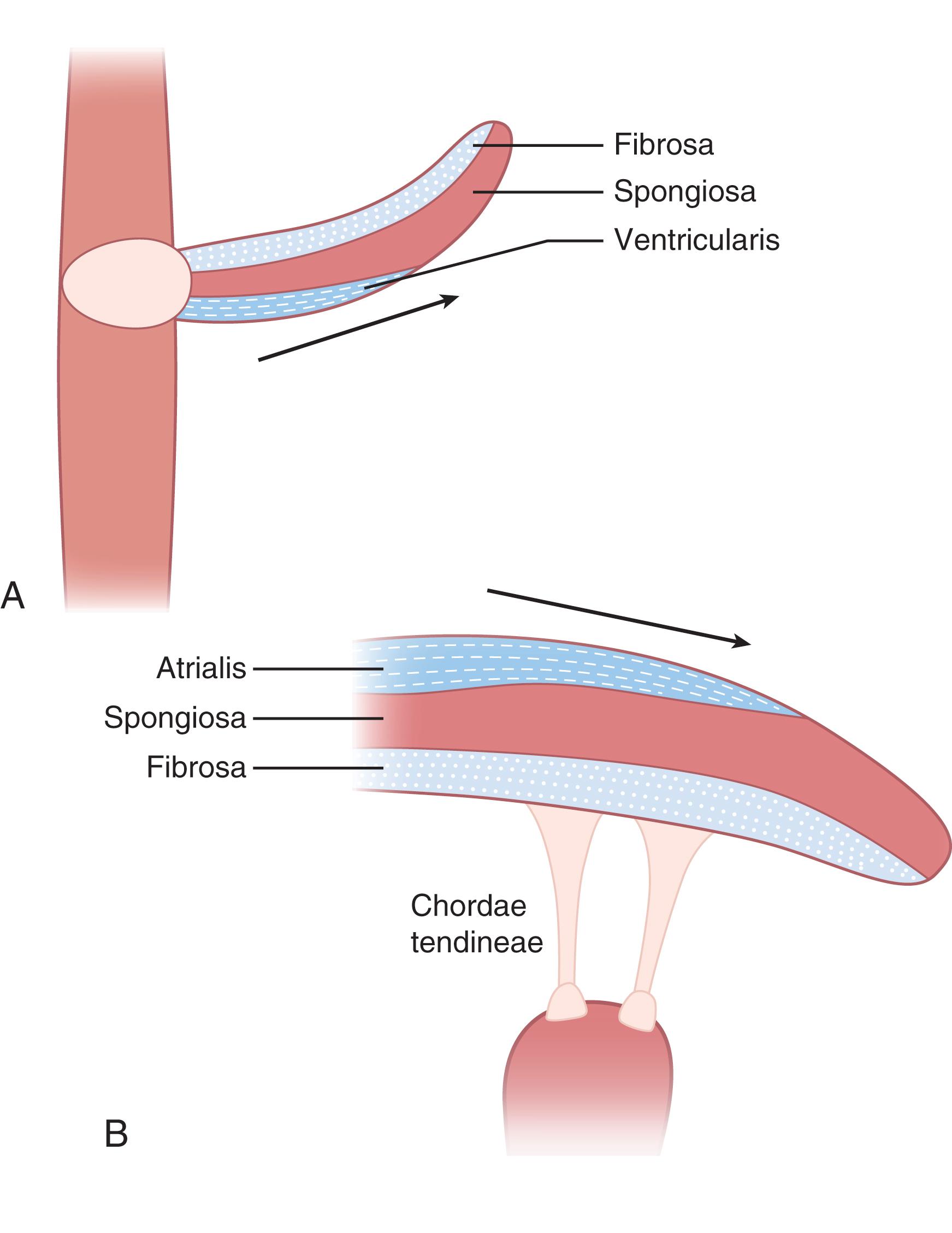 Fig. 61.3, Valve histology. The mature valve is composed of a highly organized extracellular matrix, which is compartmentalized into three layers: the fibrosa (F), made of fibrillar collagen; the spongiosa (S), made of proteoglycans; and either the ventricularis (V) of the semilunar valves or the atrialis (A) of the atrioventricular valves, made of elastin fiber.