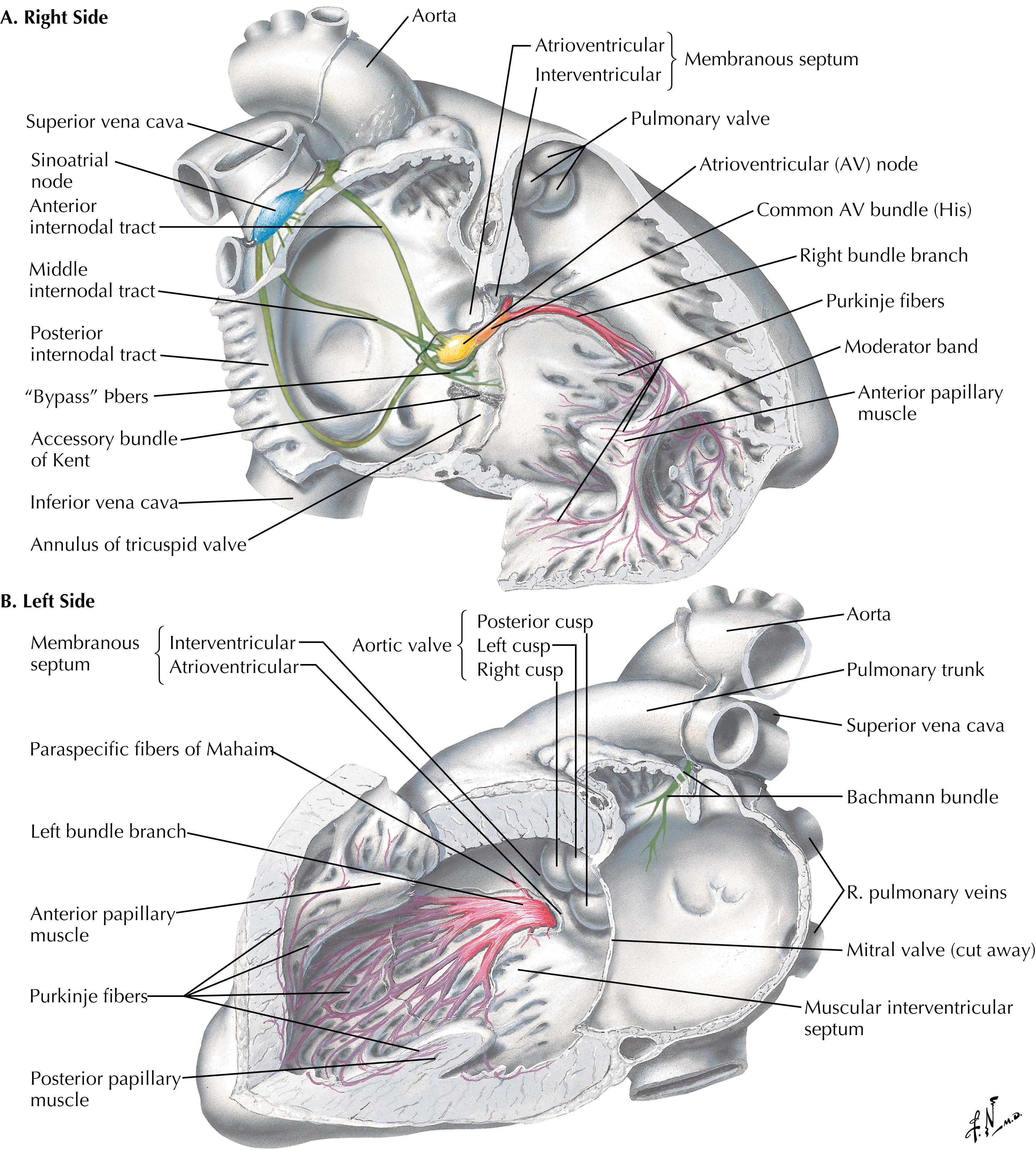 Fig. 61.9, Anatomic relations of cardiac valves and conduction system. The fibrous skeleton, which provides structure to the atrioventricular and aortic valves also contains the electrical conduction system, placing this system at risk for injury during cardiotomy for valve exposure and/or valve interventions by open or percutaneous techniques.