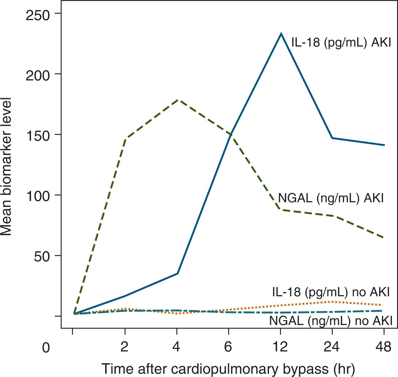 Fig. 77.1, Mean values of urine interleukin-18 (pg/mL) and neutrophil gelatinase-associated lipocalin (ng/mL) over the first hours after cardiopulmonary bypass in infants who develop acute kidney injury (50% increase in serum creatinine) compared with those who did not develop acute kidney injury. AKI , Acute kidney injury; IL-18 , interleukin-18; NGAL , neutrophil gelatinase-associated lipocalin.