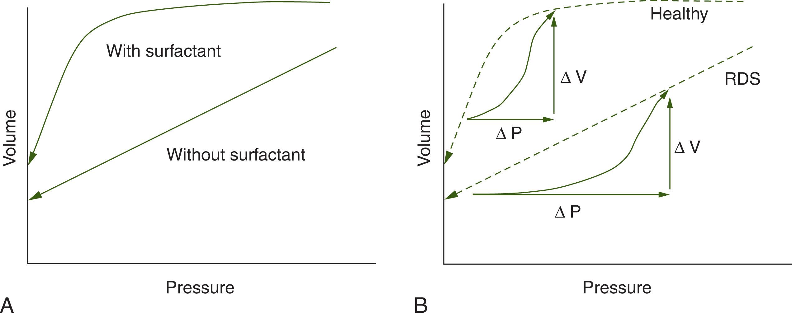 Fig. 42.5, Effect of Surface Forces on Pressure–Volume Relationships. During deflation (A) the lungs with surfactant retain gas even at very low pressures, because of falling surface tension as the alveoli get smaller. The alveoli without surfactant collapse as they get smaller. During inflation of respiratory distress syndrome (RDS) lungs (B), the starting lung volume (functional residual capacity) is lower, and much more pressure is required during inflation, compared with healthy lungs.