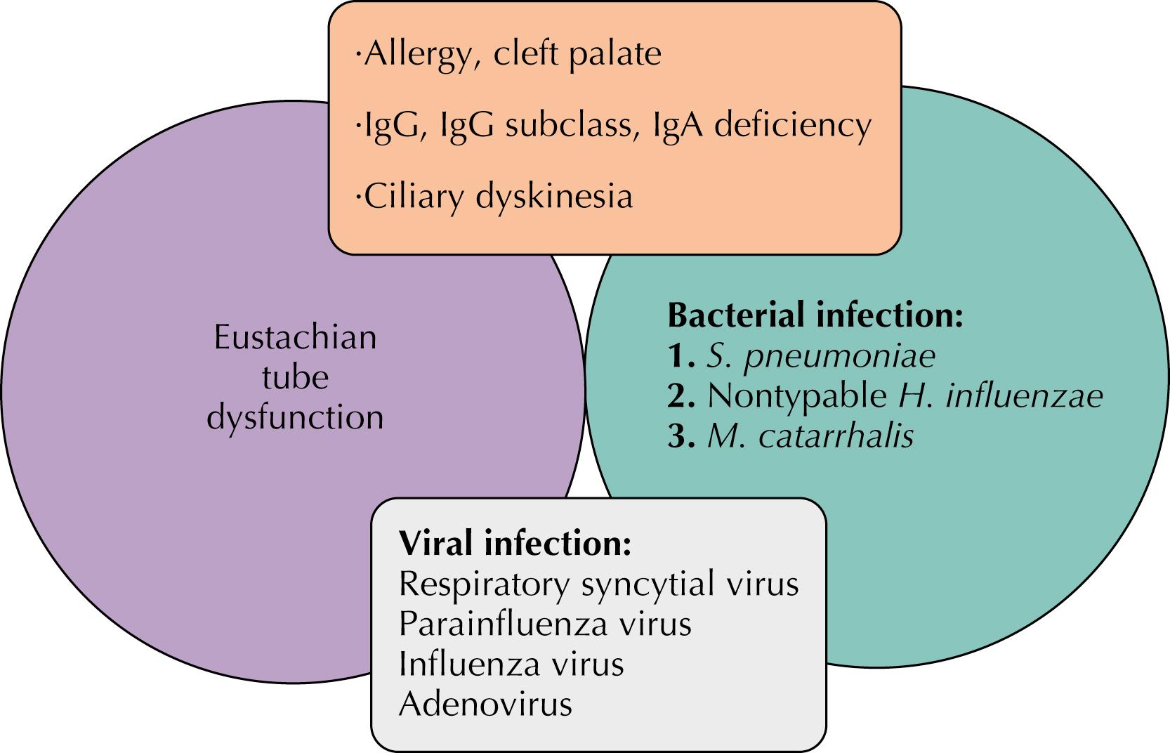 Fig. 32.2, Pathogenesis of otitis media. IgA, Immunoglobulin A; IgG, immunoglobulin G.