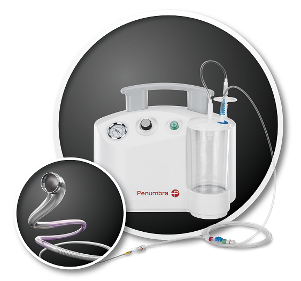 Fig. 61.8, A Penumbra aspiration pump and catheter ( inset ) and.