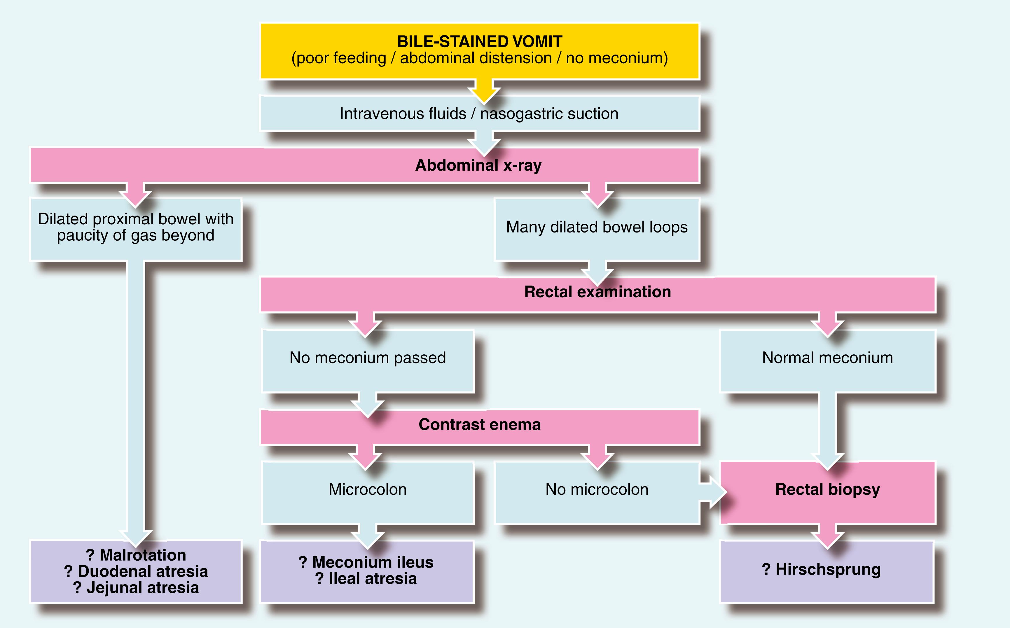 Fig. 50.2, Plan for Investigating and Managing Babies With Suspected Intestinal Obstruction.