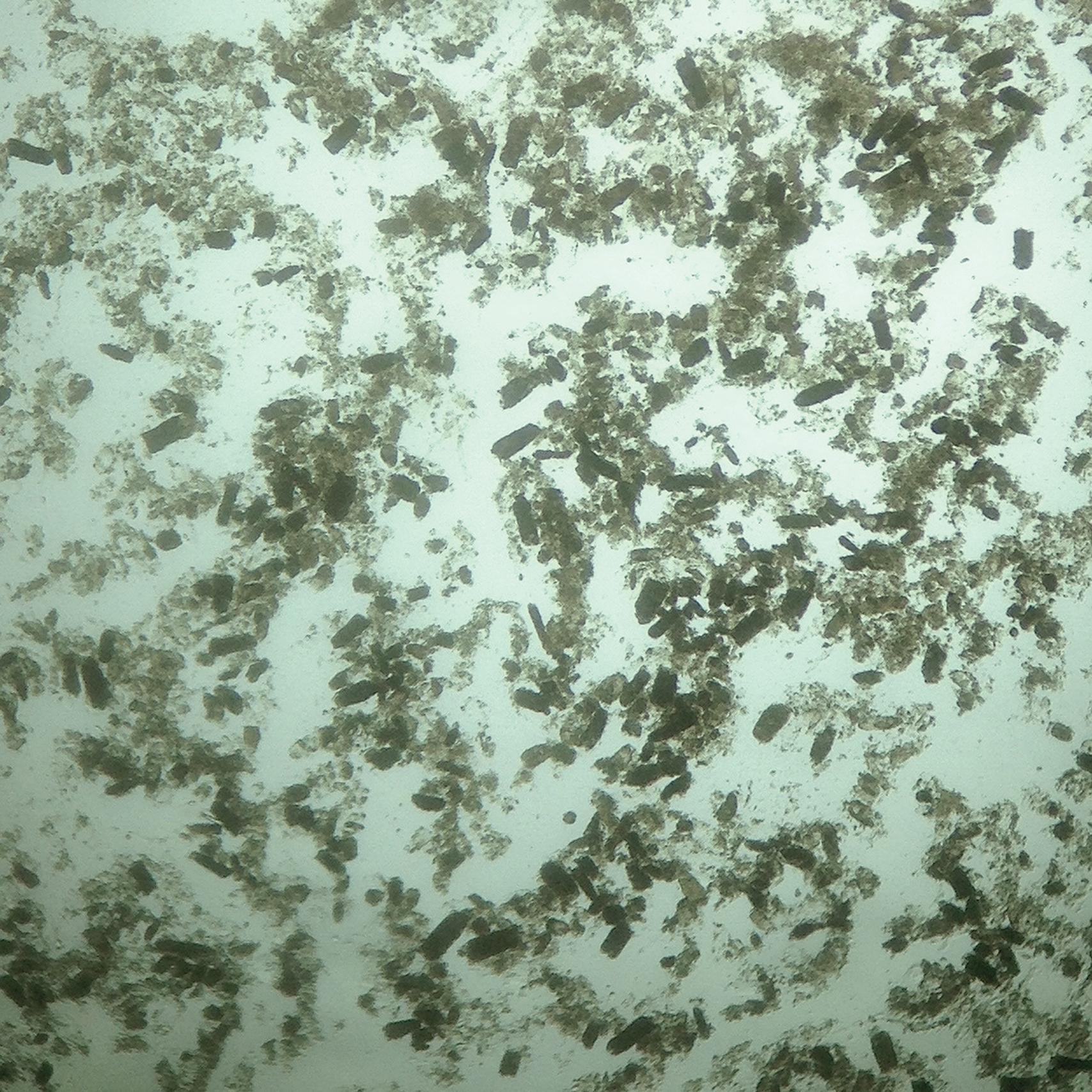 Fig. 32.1, Low-power view of the urine sediment demonstrates a low-power field (×40) of ATI with a large number of muddy brown casts. (Courtesy Randy Luciano, MD, Yale University.)