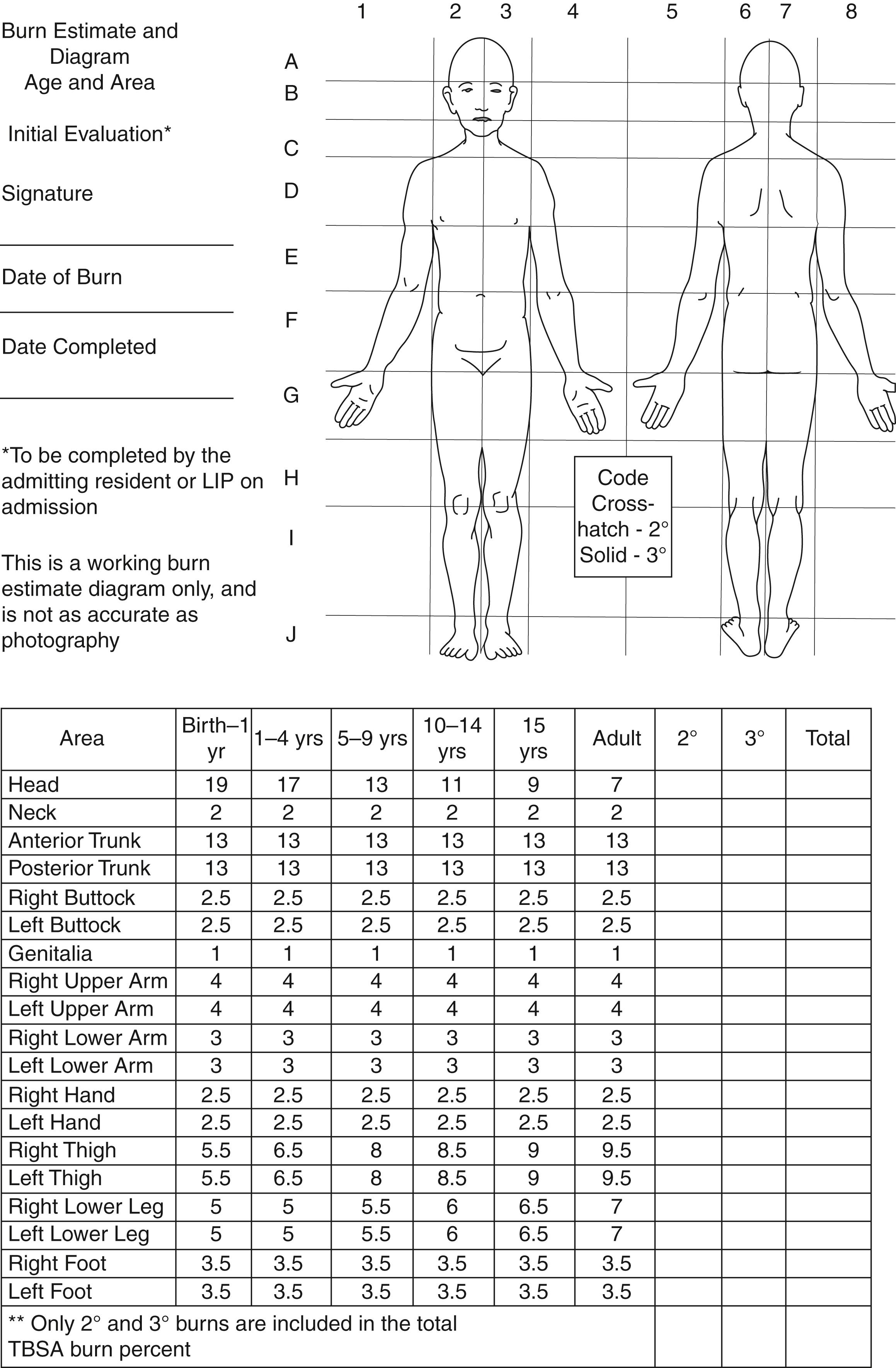 Fig. 87.2, Lund-Browder burn diagram and table.