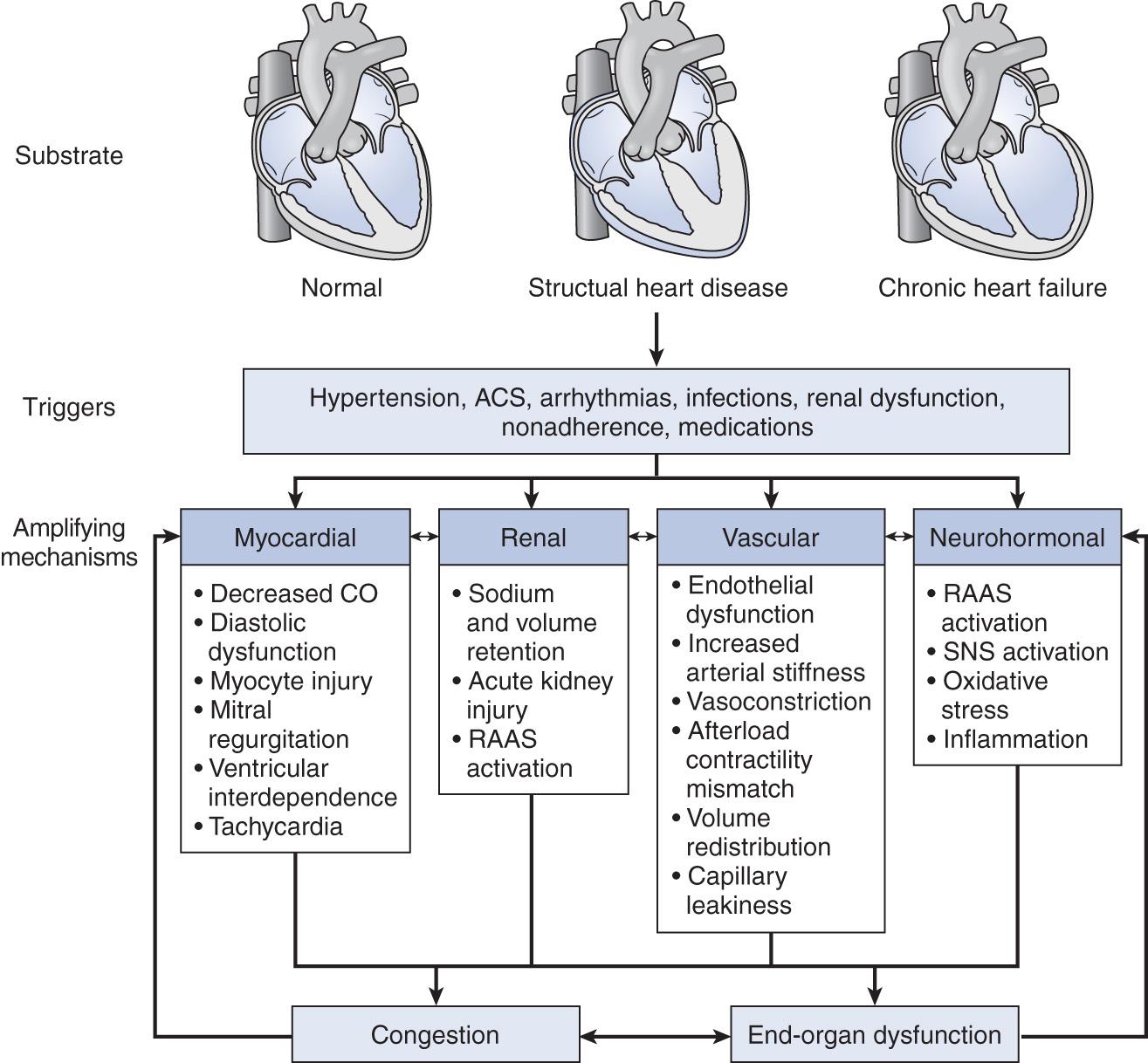 Fig. 26.1, A schematic representation of the pathophysiology of acute heart failure. ACS , Acute coronary syndrome; CO , cardiac output; RAAS , renin-angiotensin-aldosterone system; SNS , sympathetic nervous system.