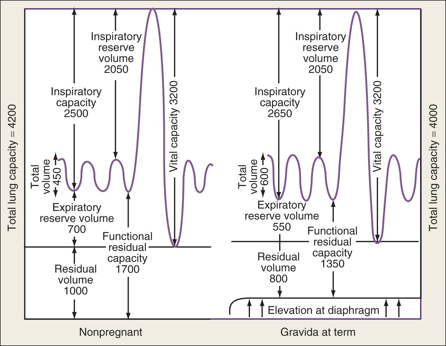 Fig. 133.1, Respiratory changes in pregnancy.