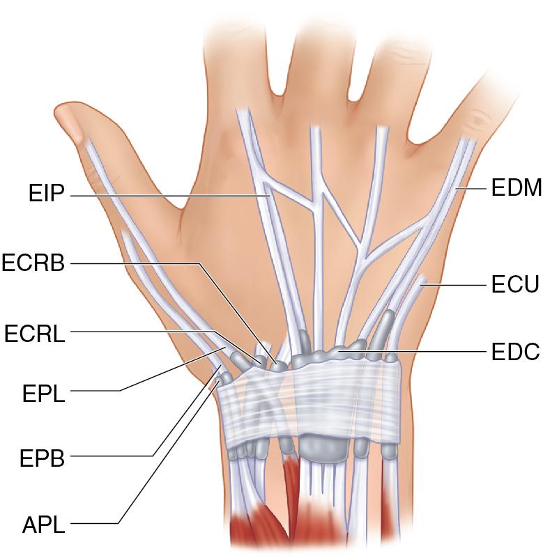 FIGURE 82.4, APL , Abductor pollicis longus; ECRB , extensor carpi radialis brevis; ECRL , extensor carpi radialis longus; ECU , extensor carpi ulnaris; EDC , extensor digitorum communis; EDM , extensor digitorum minimi; EIP , extensor indicis pollicis; EPB , extensor pollicis brevis; EPL , extensor pollicis longus.