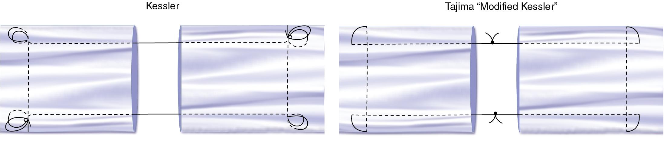 FIGURE 78.5, Two-strand suture methods.