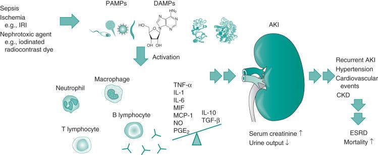 FIGURE 83.1, Schematic figure of sepsis, ischemia, or nephrotoxic agents leading to the activation of the innate and adaptive immune system via pathogen-associated molecular patterns (PAMPs, e.g., LPS) and damage-associated molecular patterns (DAMPs, e.g., adenosine). Depending on the quality and magnitude of the ensuing immune response, kidney dysfunction meeting AKI diagnostic criteria can occur. AKI increases the incidence of recurrent AKI, distant organ dysfunction, and CKD, thus enhancing the susceptibility to ESRD and accelerated mortality. AKI, Acute kidney injury; CKD, chronic kidney disease; DAMPs, damage-associated molecular patterns; ESRD, end-stage renal disease; IL-1, interleukin-1; IL-6, interleukin-6; IL-10, interleukin-10; IRI, ischemia-reperfusion injury; MCP-1, monocyte chemoattractant protein-1; MIF, macrophage migration inhibitory factor; NO, nitric oxide; PAMPs, pathogen-associated molecular patterns; PGE 2 , prostaglandin E 2 ; TGF-β, transforming growth factor-β; TNF-α, tumor necrosis factor-α.