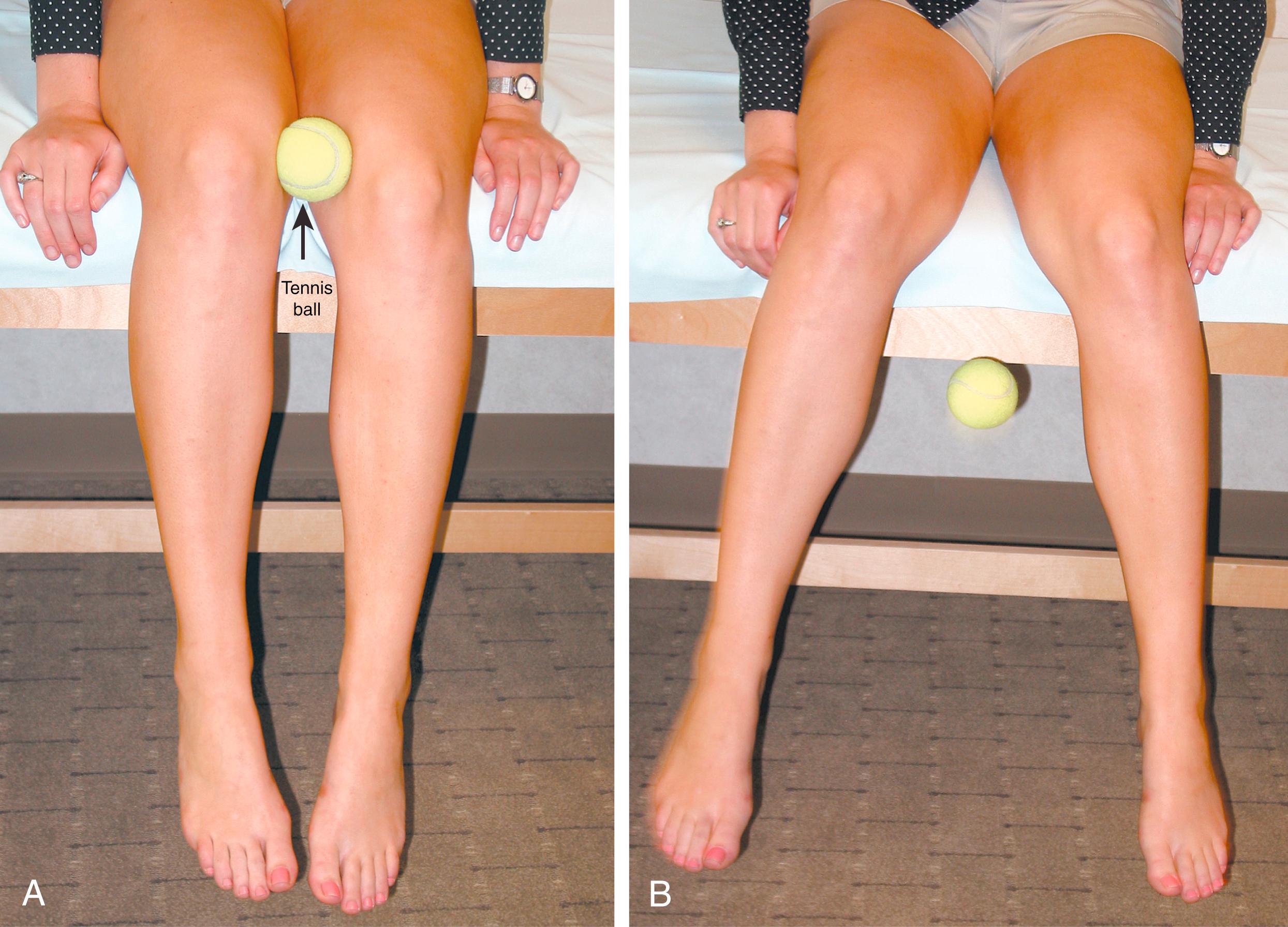 FIG. 124.1, A and B, Waldman knee squeeze test for adductor tendinitis.