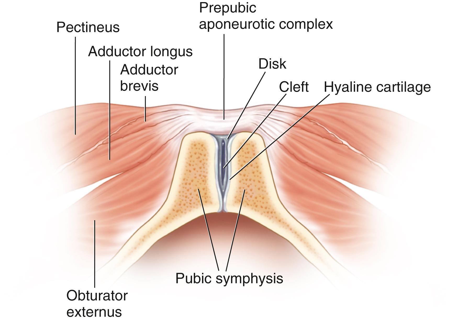 FIG. 124.7, Axial section through the pubic symphysis below the level of the pubic crest, demonstrating the anatomy of the adductor muscles. Note the origin of these muscles from the prepubic aponeurotic complex, which is an extension of the underlying fibrocartilaginous pubic symphysis.