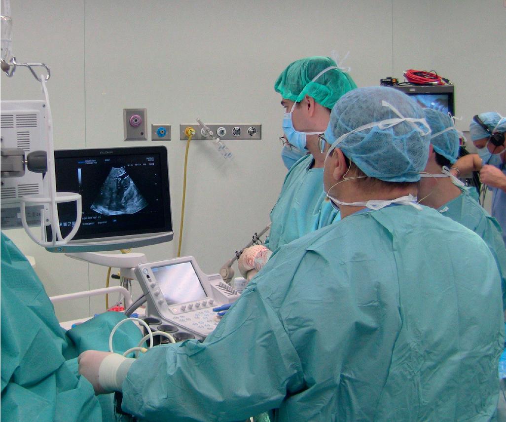 FIGURE 103.8, The ultrasound system positioned in the operating room: The operator is facing the screen while the keyboard is managed by the first or second assistant in the event a sterile pad is applied or, as in this case, by a member of the team who is not scrubbed in.