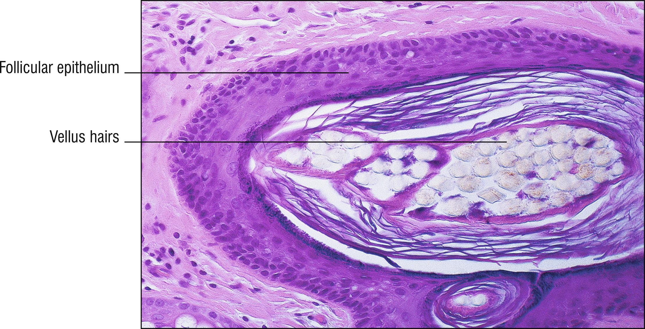 Fig. 10.4, Trichostasis spinulosa.