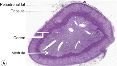 Fig. 37.3, (A) Gross morphological cross-sectional anatomy of the adrenal gland demonstrating the outer cortex and inner medulla. The thin adrenal capsule is surrounded by retroperitoneal fat. (B) Histology of the normal adrenal gland. The adrenal cortex is composed of the zona glomerulosa, zona fasciculata and zona reticularis. The zona glomerulosa produces aldosterone and other mineralocorticoids and is chiefly under the control of angiotensin II. The zona fasciculata and zona reticularis are influenced primarily by adrenocortocotrohpic hormone and produce glucocorticoids and androgens. The adrenal medulla contains the chromaffin cells, producing catecholamines, and is the major source of noradrenaline (in addition to the organ of Zuckerkandl located at the aortic bifurcation).