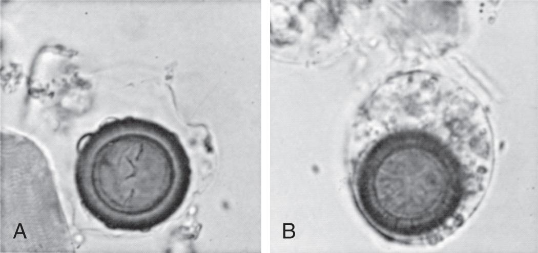 Fig. 328.1, Eggs of Taenia saginata recovered from feces (original magnification ×400).