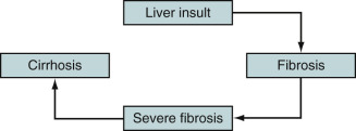 Figure 5-1, Pathophysiology of liver fibrosis. Irrespective of the cause of chronic liver disease, if left undiagnosed and hence untreated, it progresses to cirrhosis.