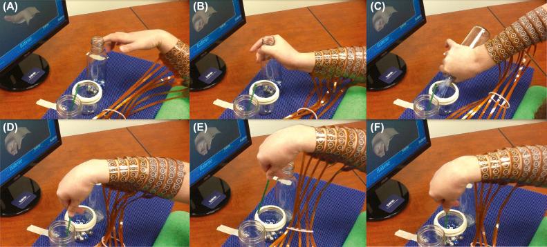 Figure 29.3, Functional movements achieved by a paralyzed study participant using an electronic neural bypass linking decoded brain activity to muscle activation in real time.