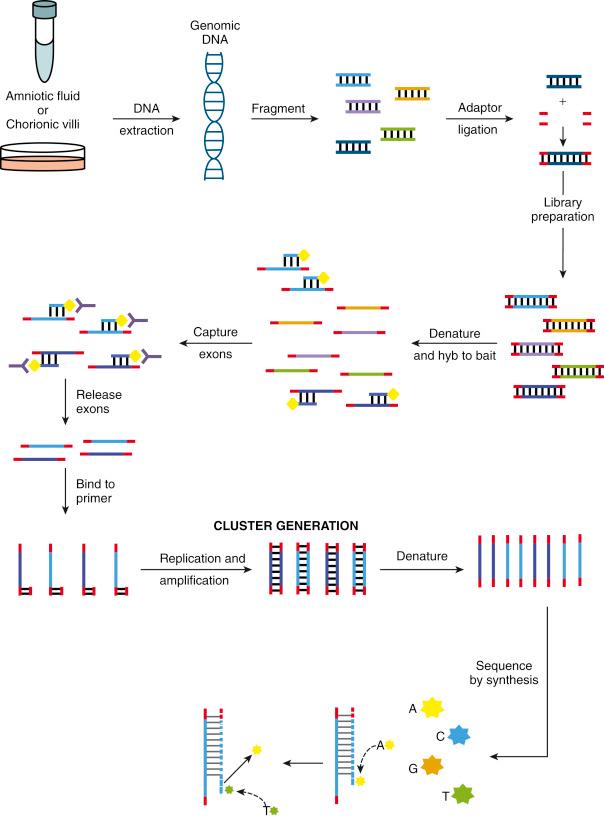 • Fig. 25.2, Whole-exome sequencing (WES) workflow. First, genomic DNA isolated from amniotic fluid or chorionic villus sampling (or cultured cells from such samples) is fragmented. Linkers are added to the DNA fragments to prepare the sequencing library. The DNA fragments are then denatured and hybridised to a bait to ensure isolation of desired DNA fragments, such as all exons (capture), and discarding the unwanted sequences, that is, all noncoding exons, introns and intergenic sequences (enrichment). The baits can be selected to capture all exons for or only exons of a specific subset of genes for gene panels. After the desired fragments are isolated, the baits are released, and sequencing can be performed. Note that for WGS, there is no selection step with the initial denaturation, and the sequencing is done on the entire library of fragments.