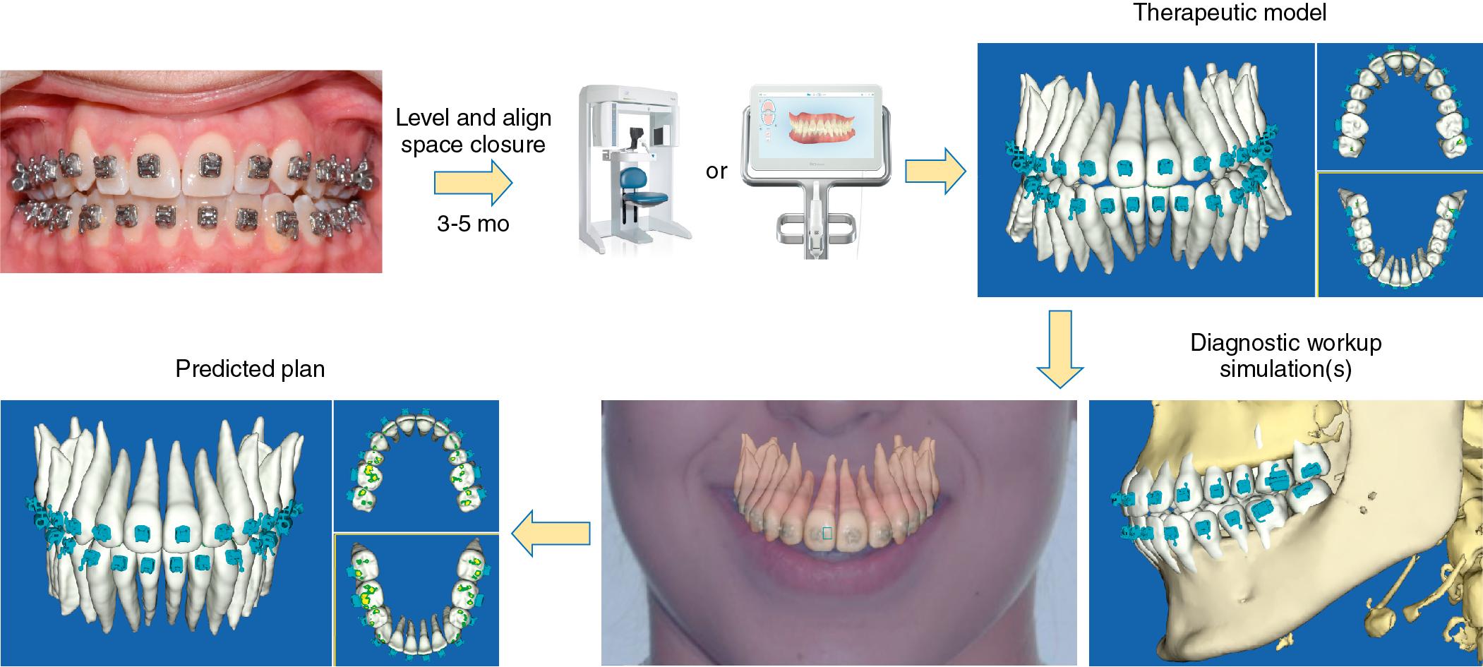 Fig. 18.1, Overview of the SureSmile process as described in the chapter.