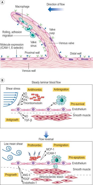 Figure 2.5, A, Leukocyte-endothelial interactions on a venous valve. ICAM-1 , intercellular adhesion molecule-1. B, Summary of contrasting effects of steady, laminar shear stress ( upper panel ) and turbulent or reversing shear stress ( lower panel ) on vessel walls. ANG II , angiotensin II; MCP-1 , monocyte chemotactic protein-1; NO , nitric oxide; PDGF , platelet-derived growth factor; PGI 2 , prostacyclin; TGF-β , transforming growth factor beta; t-PA , tissue plasminogen activator; VCAM-1 , vascular cell adhesion molecule-1.