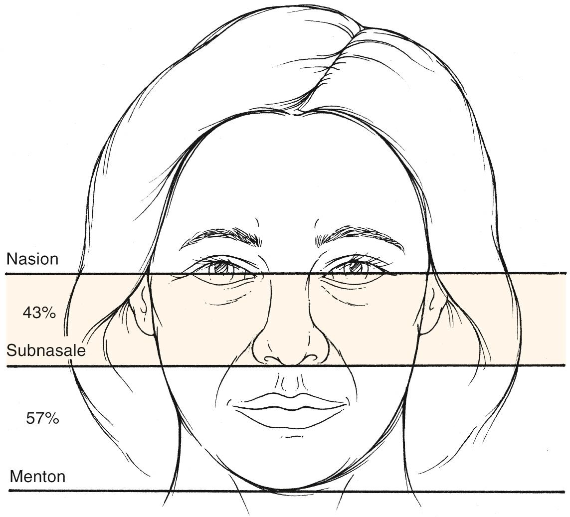 Fig. 16.9, Middle and lower facial height. Division of height is unequal and is measured from the nasion to subnasale and from the subnasale to the menton.