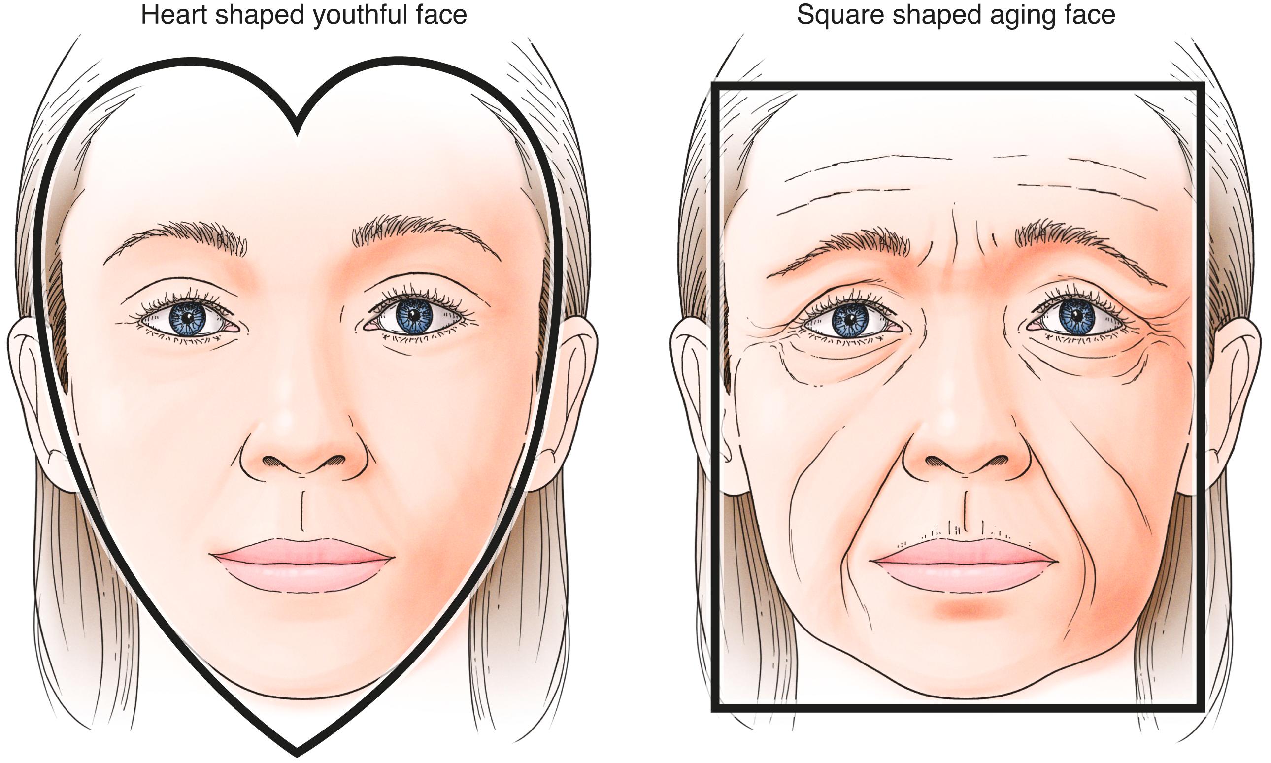 Figure 7.13, The heart-shaped face of youth becomes the square-shaped face of the aged.