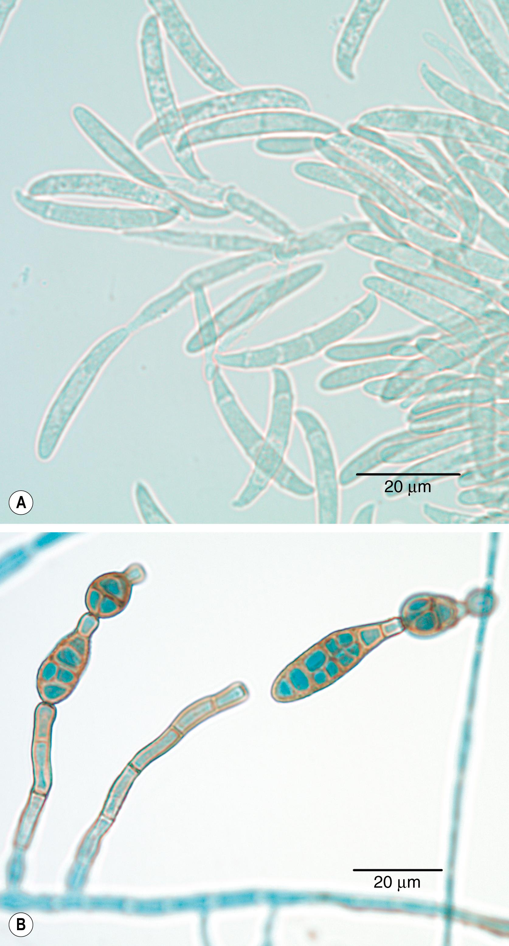 FIGURE 245.2, (A) Crescent-shaped macroconidia of Fusarium spp. (B) Club-shaped conidia of Alternaria spp.