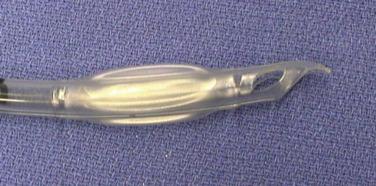 Fig. 14.12, Parker Flex-Tip tracheal tube bevel.